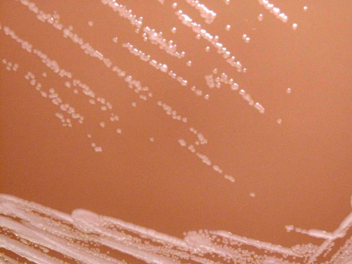 Қоректік ортада өскен Achromobacter xylosoxidans бактерияларының колониялары